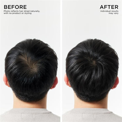 Dr. Groot Thickening Serum, Shampoo, Conditioner, and Scalp Treatment Set for Hair Loss – Clinical Results with Biotin and Rosemary for Hair Thinning, Shedding, Scalp Repair and Treatment