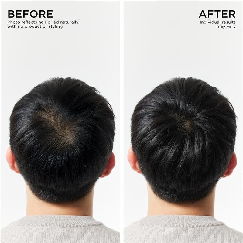 Hair Thickening Conditioner For Hair loss, Thinning Hair, Korean Hair Care, Biotin Scalp Treatment, Clinically Tested, Thicker Hair, Reduces Oil