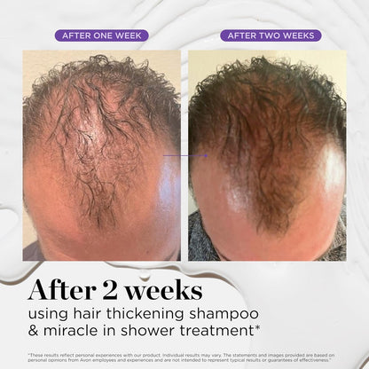 Miracle in Shower Moisturizing Treatment for Hair Loss, Korean Hair Care Rinse, Rosemary Oil for Smooth, Healthier-Looking Hair in 5 Seconds, Scalp Revitalizing Solution