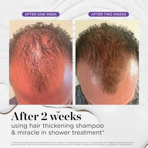 Dr. Groot Thickening Serum, Shampoo, Conditioner, and Scalp Treatment Set for Hair Loss – Clinical Results with Biotin and Rosemary for Hair Thinning, Shedding, Scalp Repair and Treatment